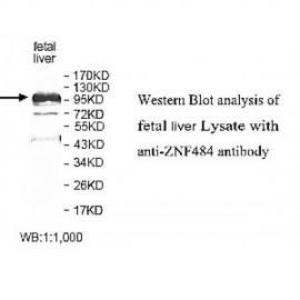 ZNF454 Antibody