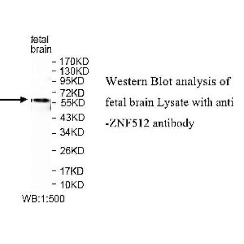 ZNF454 Antibody