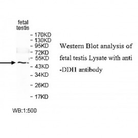 ZNF454 Antibody