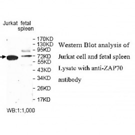 ZNF454 Antibody