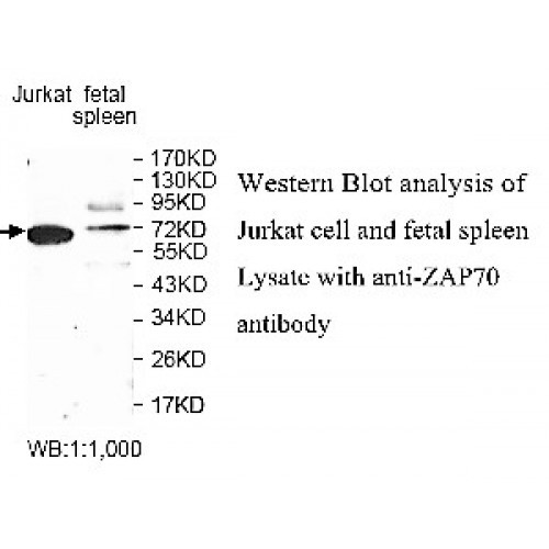 ZNF454 Antibody