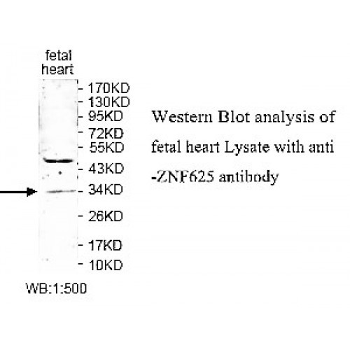 ZNF625 Antibody