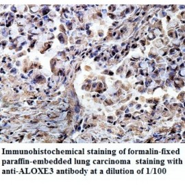 ALOXE3 Antibody