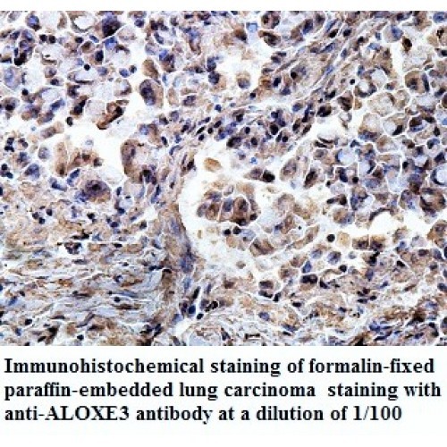 ALOXE3 Antibody