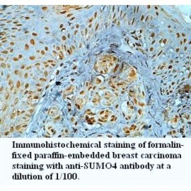 SUMO4 Antibody