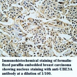 UBE3A Antibody