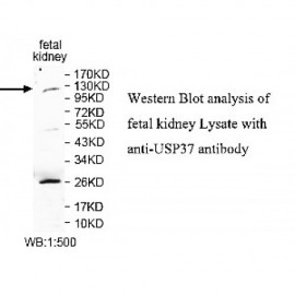 SUMO2 Antibody