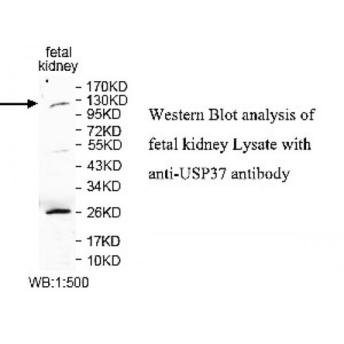 SUMO2 Antibody