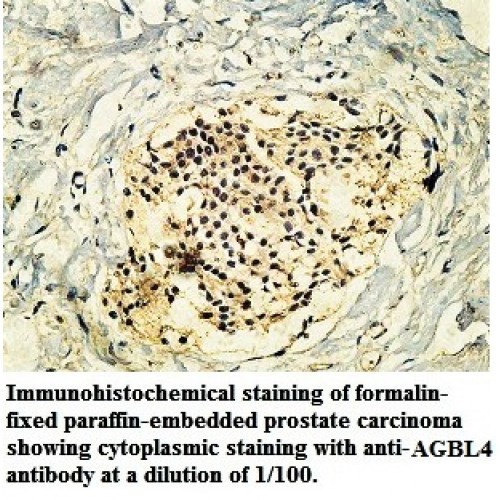AGBL4 Antibody