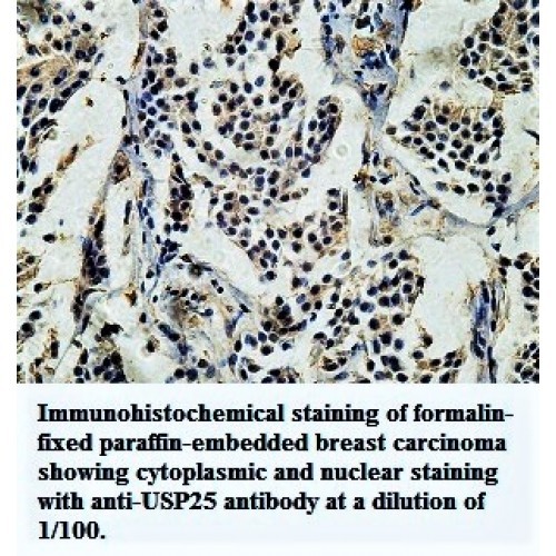 USP25 Antibody