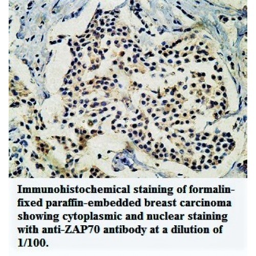 ZAP70 Antibody