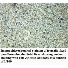 ZNF544 Antibody