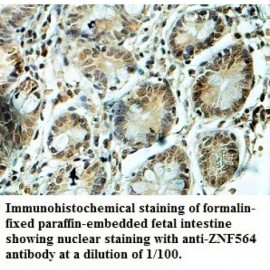ZNF564 Antibody