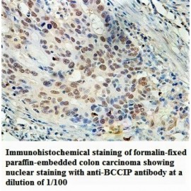 BCCIP Antibody