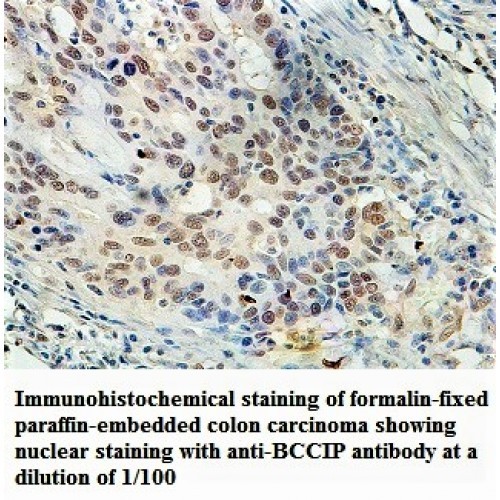 BCCIP Antibody