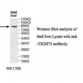 TRIM71 Antibody