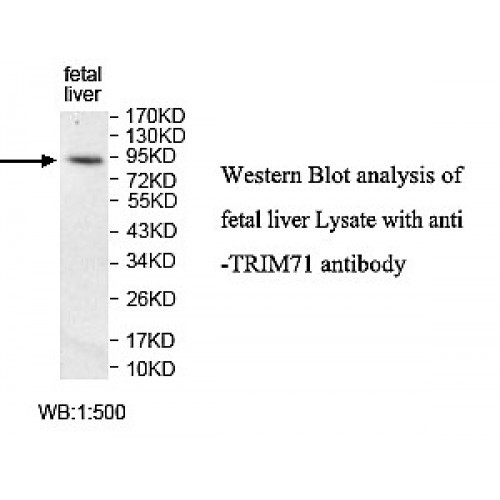 TRIM71 Antibody