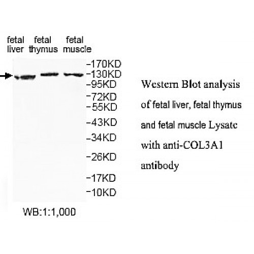 COL3A1 Antibody