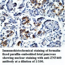 ZNF460 Antibody