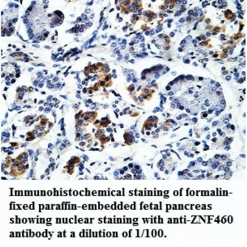 ZNF460 Antibody