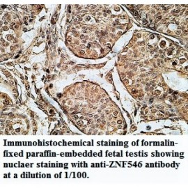 ZNF546 Antibody