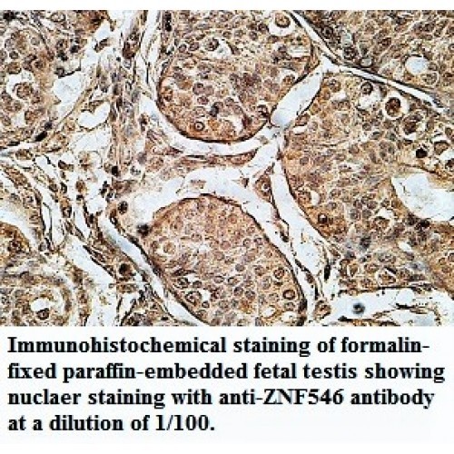 ZNF546 Antibody