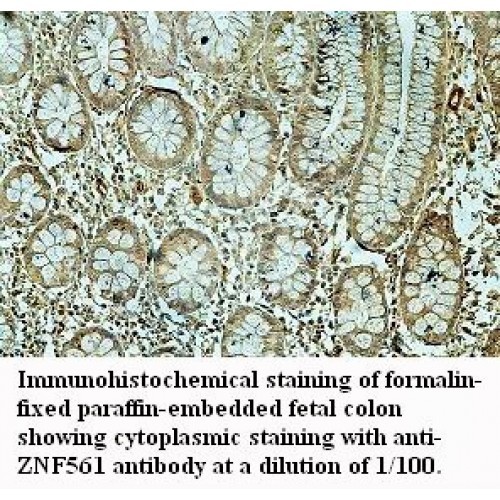 ZNF561 Antibody