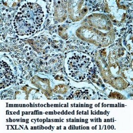 TXLNA Antibody
