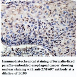 ZNF697 Antibody