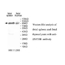 IGF2BP1 Antibody