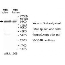 IGF2BP1 Antibody