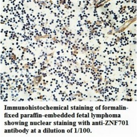 ZNF701 Antibody
