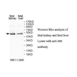 IGF2BP1 Antibody