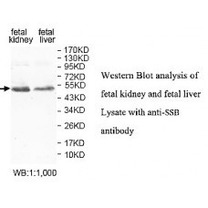 IGF2BP1 Antibody