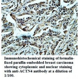 ACTN4 Antibody