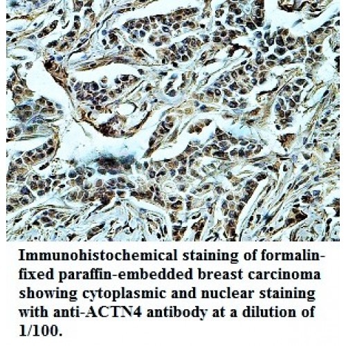 ACTN4 Antibody