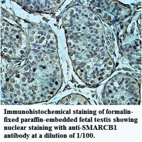 VCAM1 Antibody