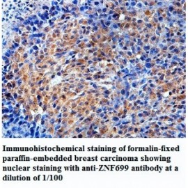 ZNF699 Antibody