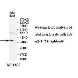 ZNF75D Antibody