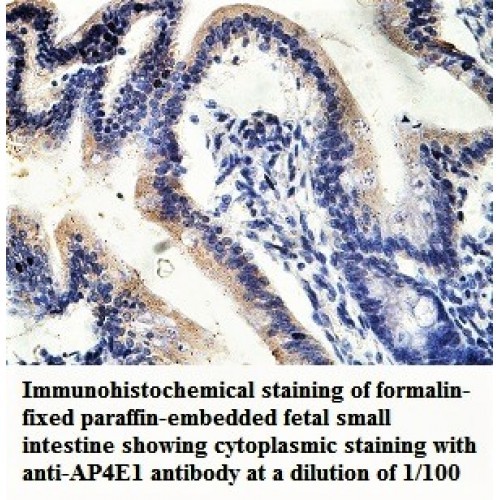 AP4E1 Antibody