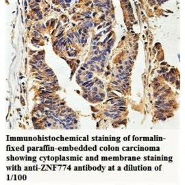 ZNF774 Antibody