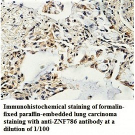 ZNF786 Antibody