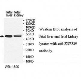 ZNF829 Antibody