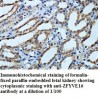 ZFYVE16 Antibody