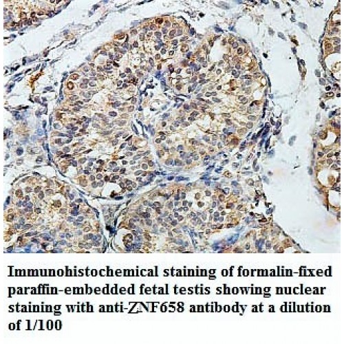 ZNF658 Antibody