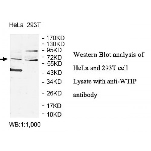 WTIP Antibody