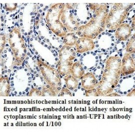 UPF1 Antibody