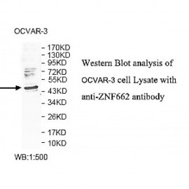 ZNF662 Antibody