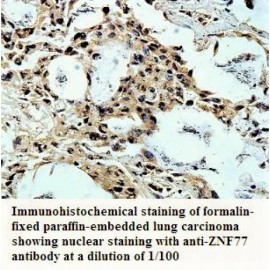 ZNF77 Antibody