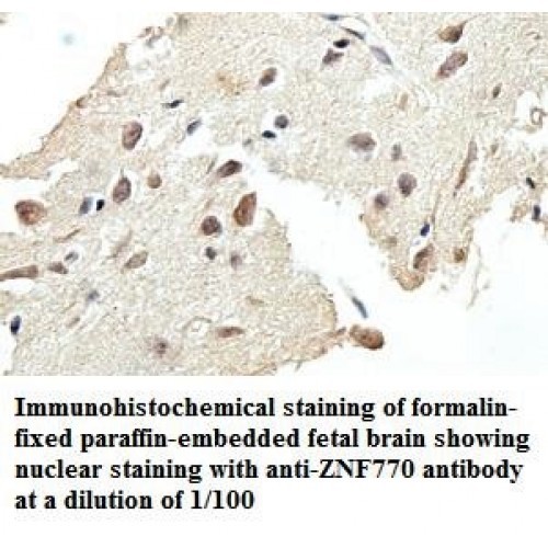 ZNF770 Antibody